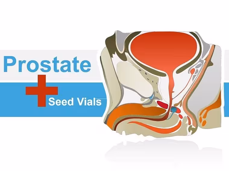 Prostate Anatomy Keynote Shapes - Instant Download | ImagineLayout