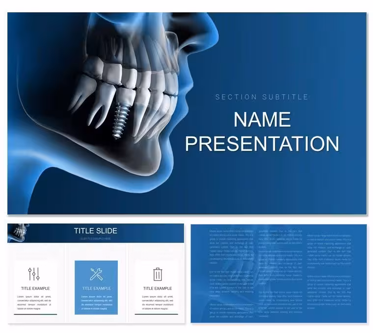 Dental Implants PowerPoint Template: Implant Precision Visualized