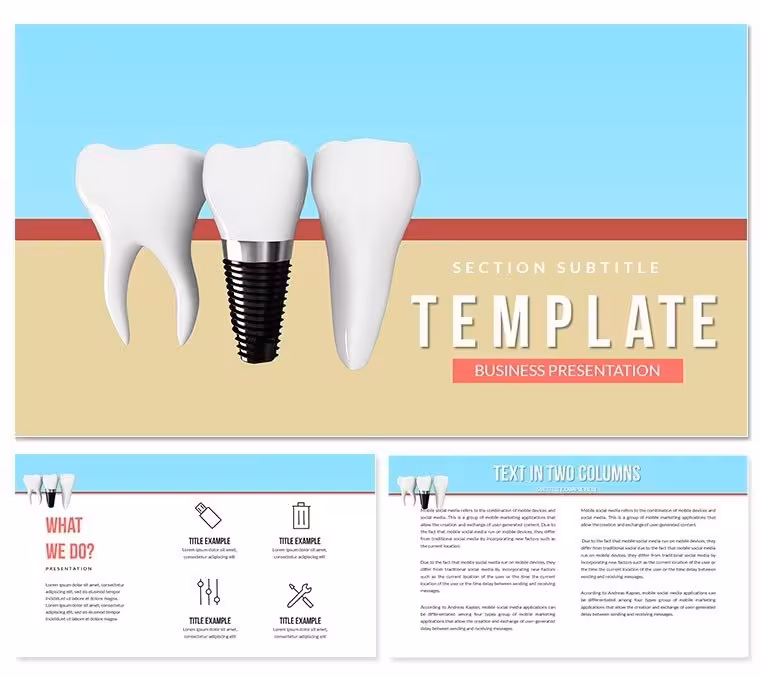 Dental Implants PowerPoint template