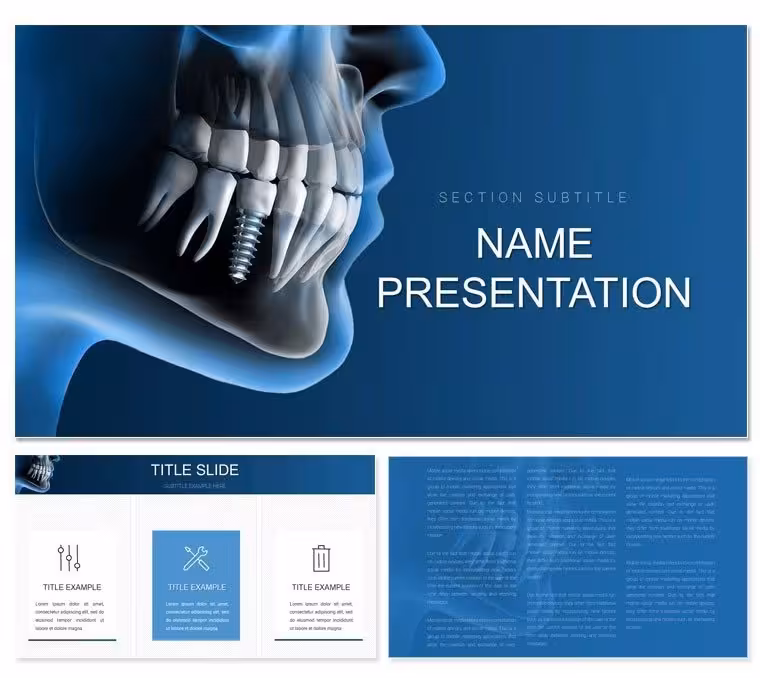 Dental Implants Keynote Template: Crafting Confident Smiles