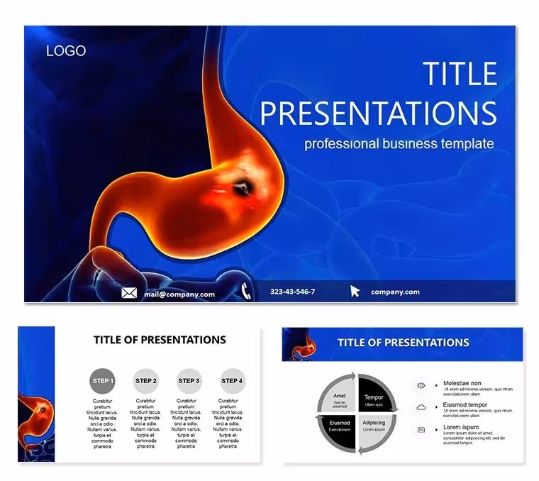 Gastric Ulcer Keynote Template: Illuminate Digestive Insights
