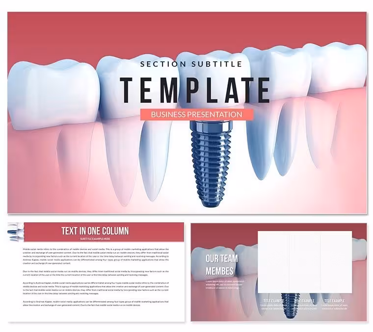Dental Implant Cost Keynote template - themes