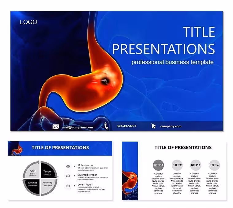 Gastric Ulcer PowerPoint Template: Heal Narratives with Sharp Visuals