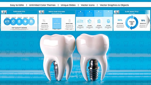 Professional Dental Implant Charts Keynote Template - 20+ Slides