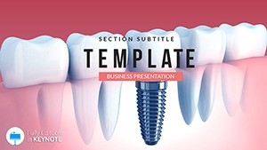 Dental Implant Cost Keynote template - themes