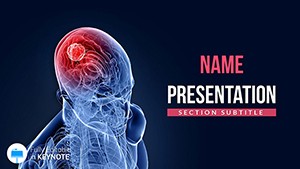 Diagnosis of Brain Cancer Keynote Templates