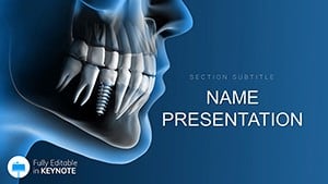 Dental Implants Procedure template for Keynote presentation