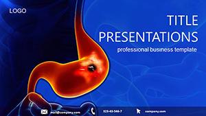 Gastric Ulcer PowerPoint templates