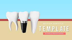 Dental Implants PowerPoint template