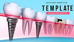 Tooth Implant PowerPoint template