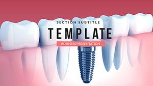 Dental Implant Cost PowerPoint template