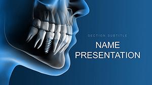 Dental Implants Procedure PowerPoint Template | Professional Infographic