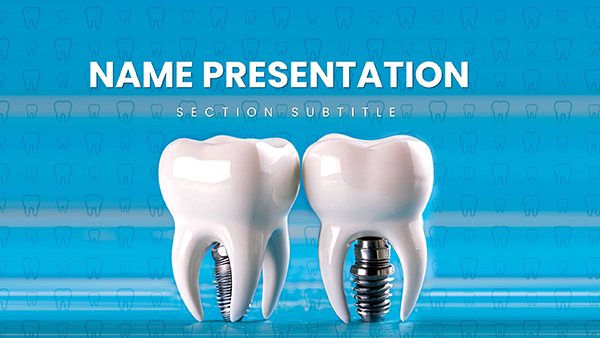 Enhance Your Dental Presentations with the Dental Implant PowerPoint Template