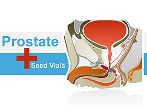 Prostate PowerPoint Shapes: Downlaod Presentation Template