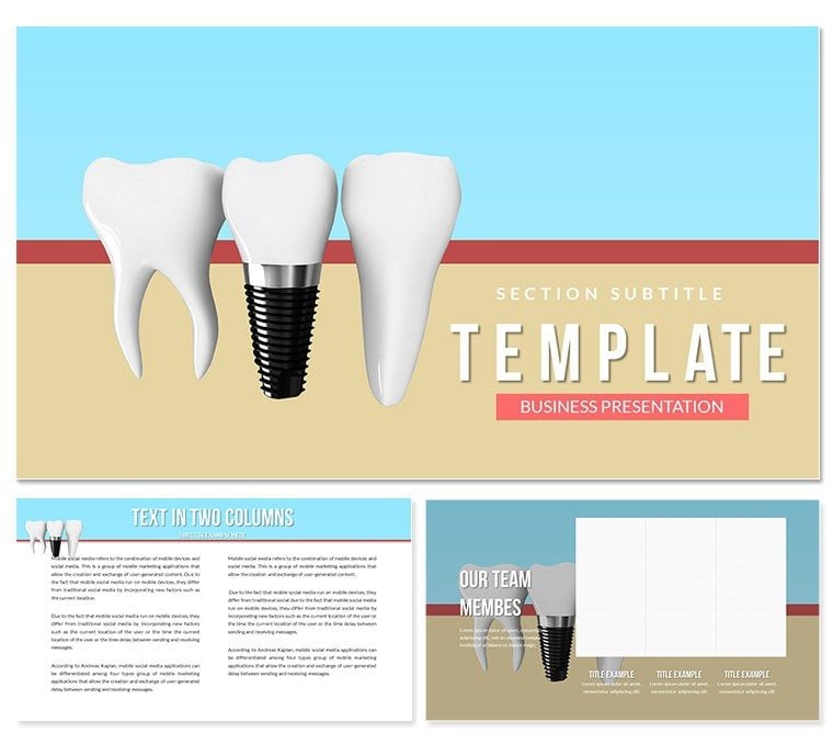 Dental Implants Keynote template