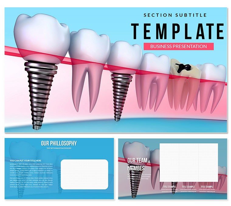 Tooth Implant Keynote template