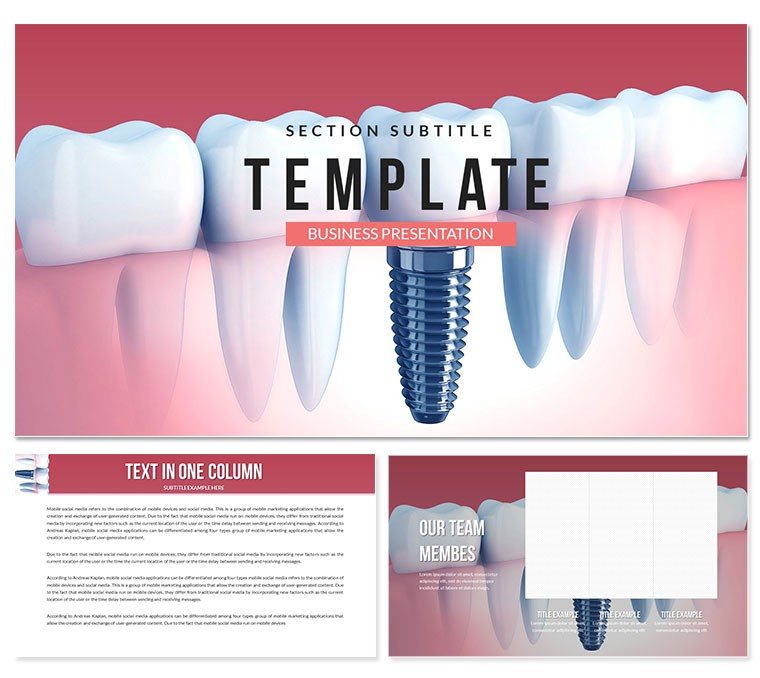 Dental Implant Cost Keynote template - themes