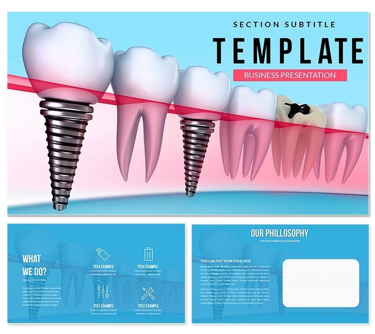Tooth Implant PowerPoint template
